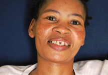 View details: Restoring dignity for people living with AIDS in South Africa View details: Restoring dignity for people living with AIDS in South Africa