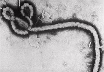 View details: MA Ebola Virus Monitoring Project View details: MA Ebola Virus Monitoring Project